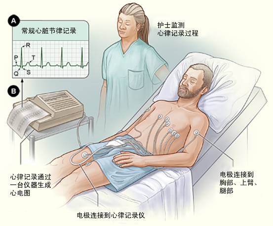 冠心病需要做哪些檢查？(圖1)