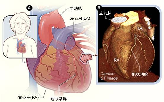 冠心病需要做哪些檢查？(圖2)